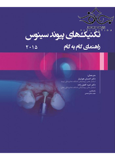 عکس تکنیک های پیوند سینوس راهنمای گام به گام 2015